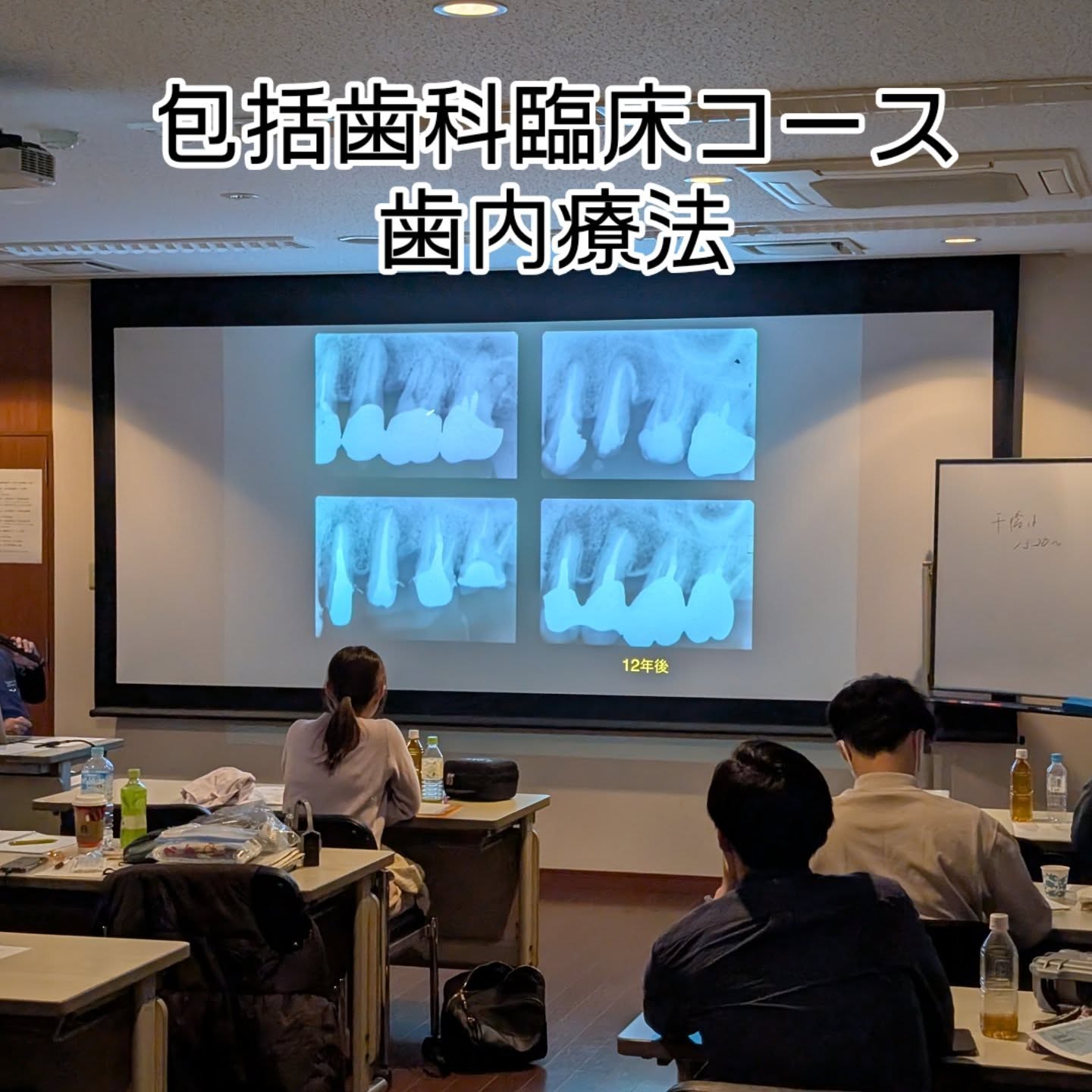 ◯筒井塾包括歯科臨床コース
本日は歯内療法の講義・実習でした。
先生方コースから懇親会までお忙しい中ありがとうございました。今後とも宜しくお願い致します。
筒井塾