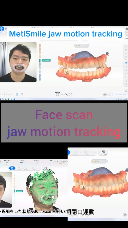 ◯筒井塾咬合療法ベーシックコース4日目
咬合療法コース内でのjaw motion trackingデモンストレーション風景です。
動画は実際のデモより短く編集しています。
本編は1月中旬より閲覧可能な「新筒井塾ホームページ」に公開予定です。筒井塾受講生の先生方はどなたでも閲覧できる動画アーカイブを準備しております。
完成しましたらまたお知らせ致します。
筒井塾