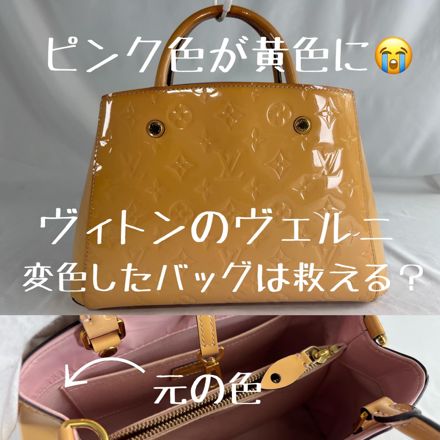 「お気に入りだったピンクのヴェルニが、気づいたら真っ黄色に…😭」
あなたのバッグも、ご確認ください!
今回ご紹介するのは、ルイ・ヴィトン【ヴェルニ モンテーニュ】の修復事例です。
エナメル特有の黄ばみ・変色。
「もう使えない」と諦める前に、レシッズにご相談ください✨
今回は、元の色に近い「大人可愛いピンク」へカラー再生いたしました!
💡ここがプロのこだわりポイント!
エナメル修理には、実は「選べる選択肢」があるんです。
1️⃣ コバ(革の断面)の色はどうする?
モンテーニュは元々コバが黒系ですが、今回はあえて本体と同色で仕上げました。
「黒を残してバキッとさせたい」か「同色でふんわりさせたい」か…
実はこれだけで修理費用も変わってきます💰
2️⃣ 内側のどこまで直す?
「外側だけでいい」のか、「蓋を開けた時の内側のパーツまで完璧にしたい」のか。
ご予算や仕上がりの希望に合わせて、最適なプランをご提案します。
「私のバッグ、いくらで直るかな?」
そう思ったら、まずはDMまたはプロフィール欄のLINEからお写真をお送りください📩
プロの職人が直接お答えします!
#ルイヴィトン修理 #エナメル修理 #ブランド修理 #愛知