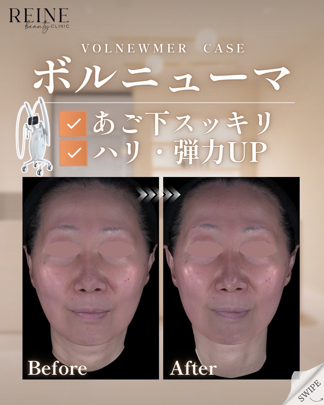 instagramの画像