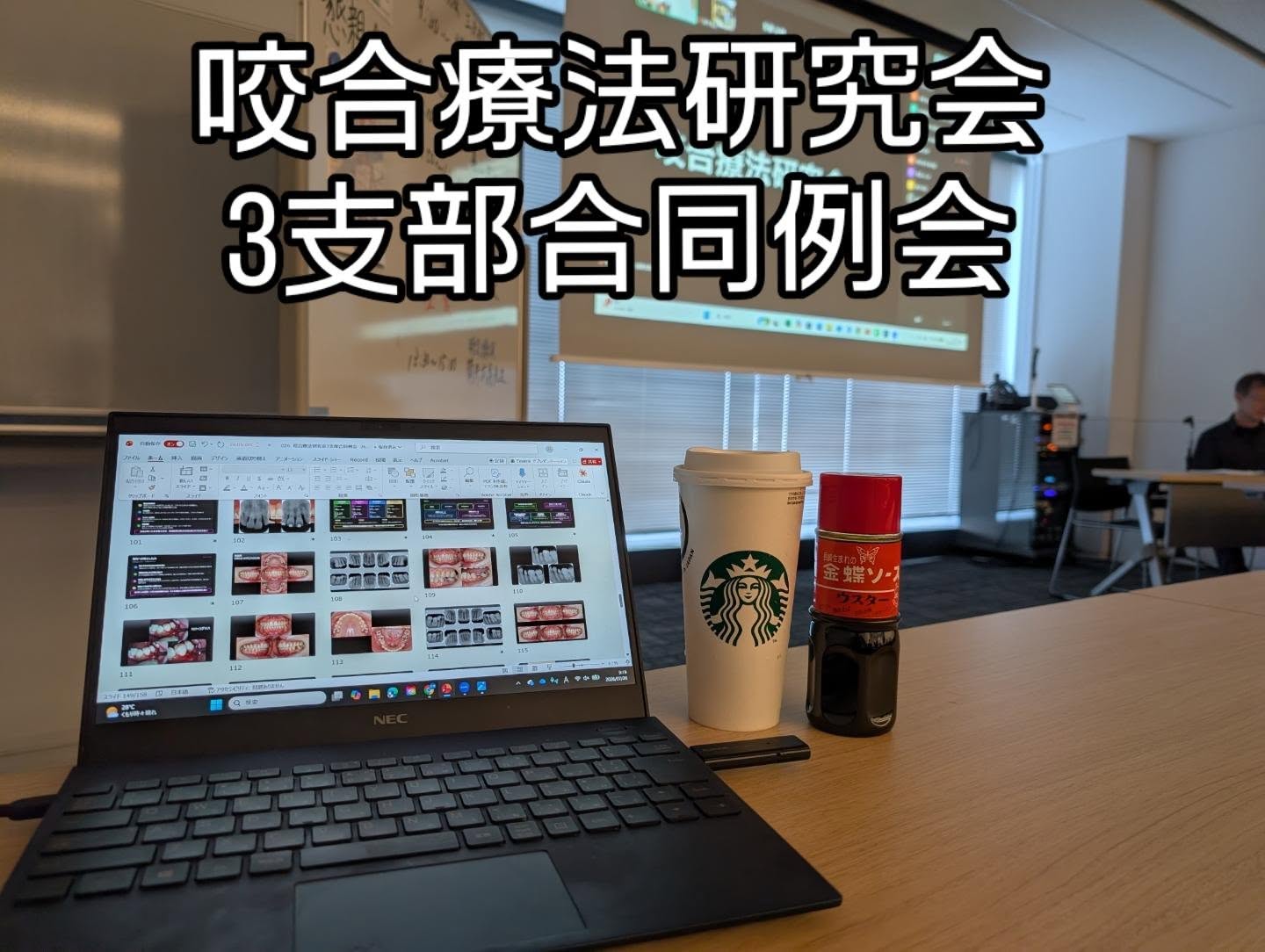 ◯咬合療法研究会3支部合同例会
本日は咬合療法研究会例会で、テーマは「歯周病・顎口腔機能障害と矯正治療」でした。皆様素晴らしい発表をされていました!
私は「歯周組織の保全と顎口腔機能の調和を目指す矯正治療」という演題で講演させて頂きました😊まだまだ足りない点が多いと感じた1日でした、精進します!
岡田先生はじめ咬合療法研究会の先生方準備含めありがとうございました🙏今後とも宜しくお願い致します🙇
