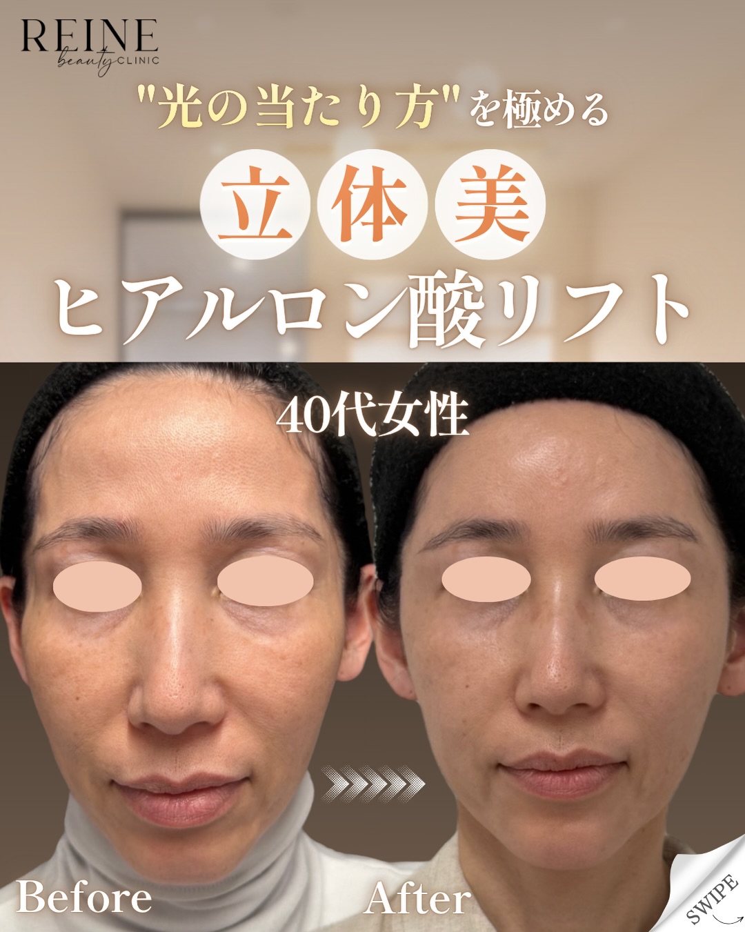 instagramの画像